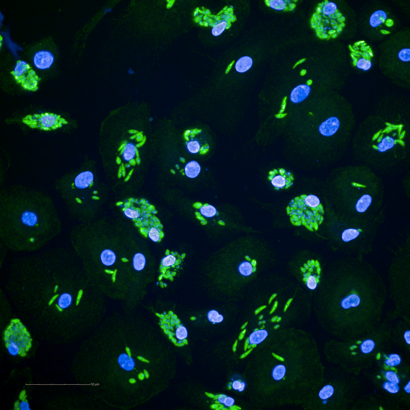 Mikroskopische Fluoreszenzaufnahme von humanen Makrophagen, die mit Leishmanien infiziert sind.