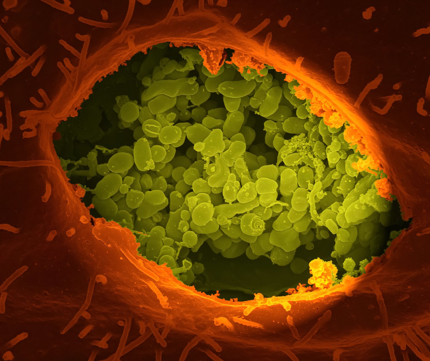 Re-stained scanning electron micrograph of a ruptured cell with coxials: A reddish-orange cell opening with many smaller light green spheres inside.
