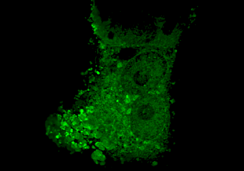 Fluorescence microscope image of greenish glowing Nipah viruses