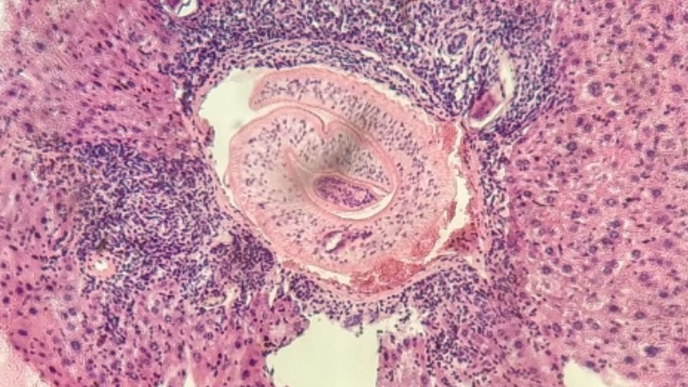 S. mansoni worm: Hematoxylin/Eosin staining of a liver section from a mouse infected with S. mansoni for 14 weeks. Zoomed in into S. mansoni parasite