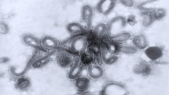 Microscopic image of Marburg virus: a black and white image of Marburg virus. In the center, a cluster of short, worm-like viruses that often bend at one end.