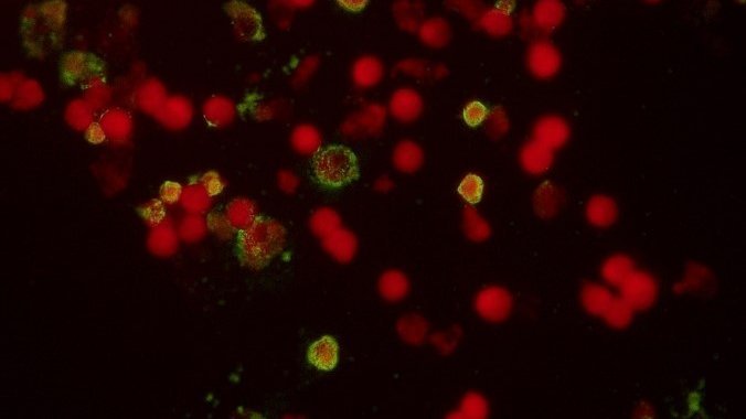 Rickettsien-Diagnostik - Indirekte Immun-fluoreszenz des Blutes. Zu sehen sind mehrere rote Kreise auf schwarzrem Grund. Einige der Roten Kugeln haben ein in grün leuchtender Schleier um den äußeren Bereich.