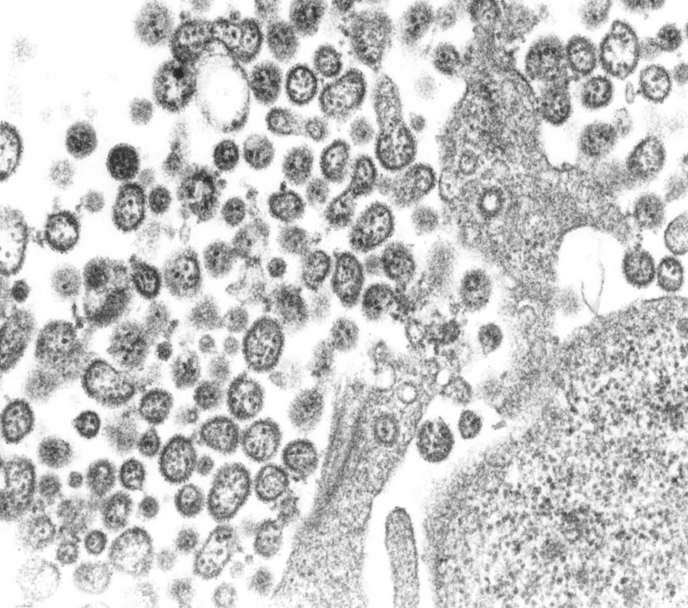 Das Foto zeigt eine elektronenmikroskopische Aufnahme von etwa 30 Lassa-Viruspartikeln.