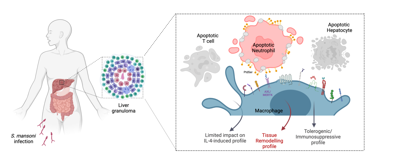 Die Grafik stellt links einen Menschen mit seinen Organen dar. Durch die Haut des rechten Oberschenkels dringen S. Mansoni-Erreger ein. In der Mitte ist ein Leber-Granulom abgebildet und ganz rechts eine Darstellung der beteiligten Immunzellen.
