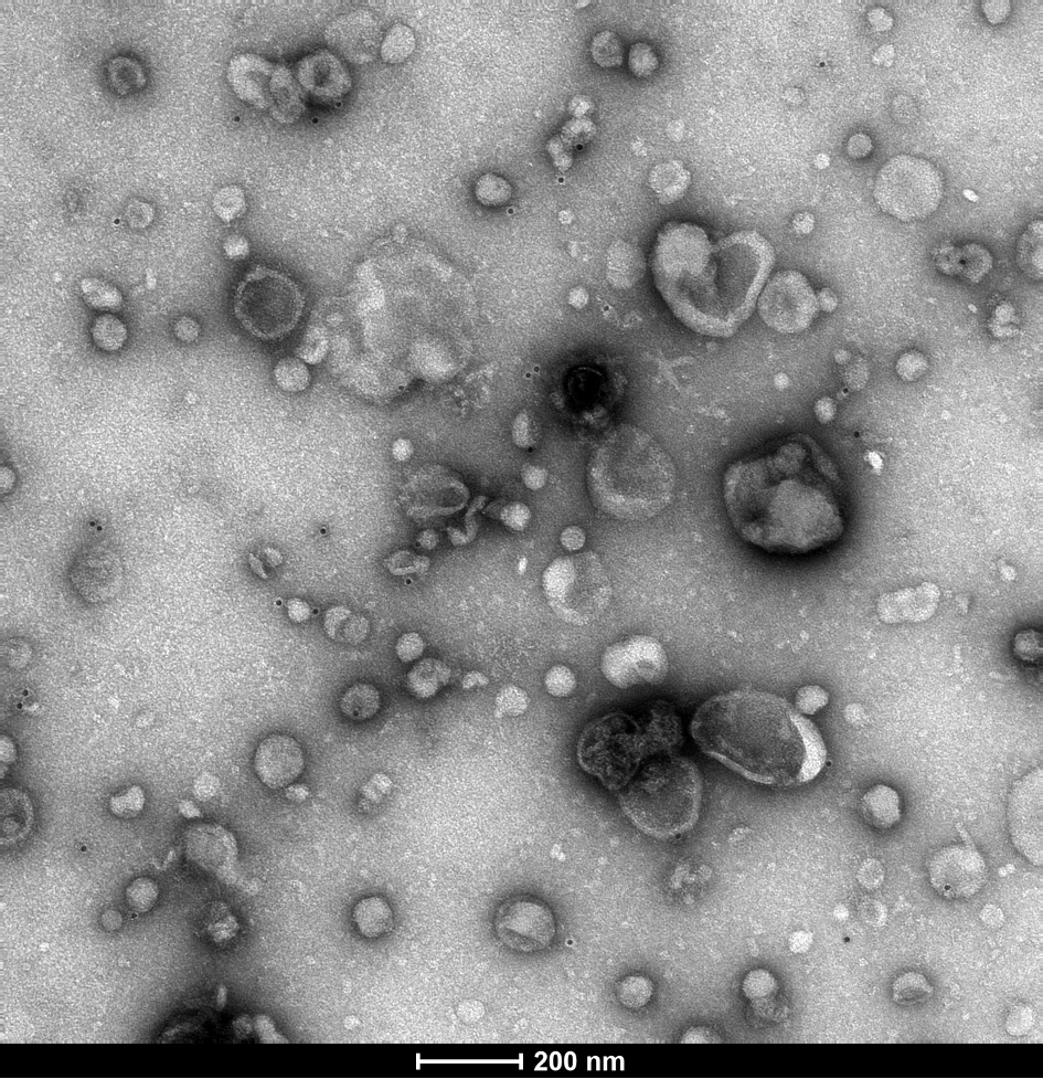 Black-and-white-transmission electron microscopy of extracellular vesicles