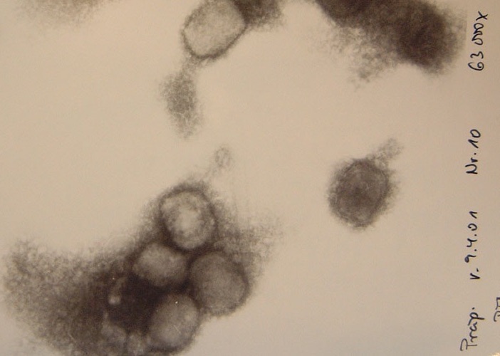 A microscopic image of monkeypox is shown. In the lower part of the image, an accumulation of four, roundish, grey-black viruses can be seen.