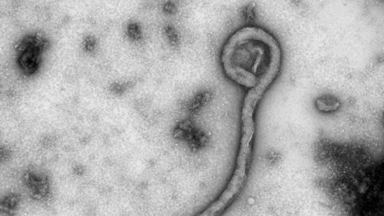 The electron microscope image shows a black-and-white image of the Ebola virus. The virus has a thread-like structure.