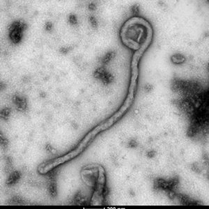 Die elektronenmikroskopische Aufnahme zeigt eine schwarz-weiße Abbildung des Ebolavirus. Das Virus besitzt eine fadenförmige Struktur.
