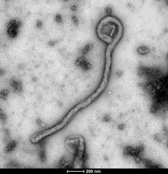 Die elektronenmikroskopische Aufnahme zeigt eine schwarz-weiße Abbildung des Ebolavirus. Das Virus besitzt eine fadenförmige Struktur.