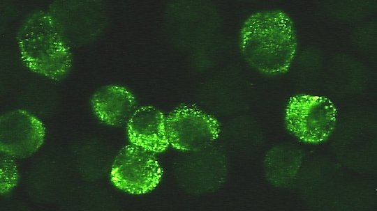 Lassa viruses under the fluorescence microscope