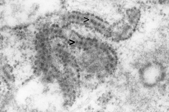 Elektronenmikroskopisches Bild von West-Nil-Viren
