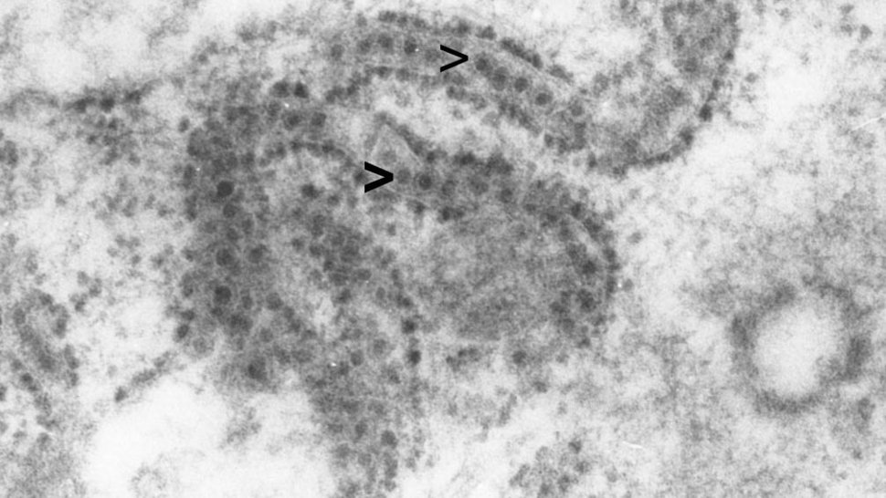 Elektronenmikroskopisches Bild von West-Nil-Viren Elektronenmikroskopisches Bild von West-Nil-Viren