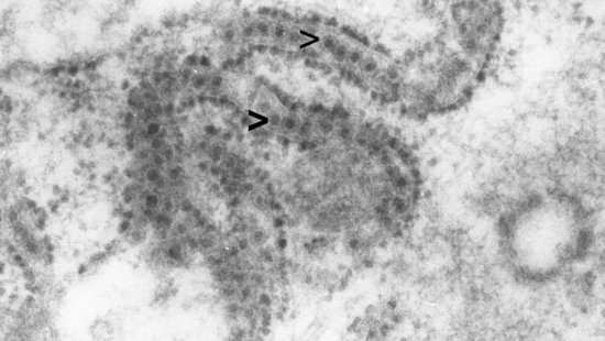 Electron microscope image of West Nile viruses