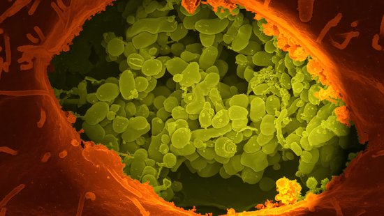 The picture shows a microscopic image of Coxiella burnetii bacteria: A reddish-orange cell opening with many smaller light green spheres inside.