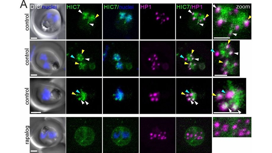 Four‑panel figure: panels A and B show malaria parasites with fluorescent labels for HIC7 (green), HP1 (magenta) and DNA (blue, grey background), where HIC7 overlaps HP1 in untreated cells but becomes dispersed after drug treatment. Panels C and D show genome tracks on chromosome 12, with HP1 signal globally reduced and especially weakened at the ap2‑g gene that controls switching into the sexual stage.