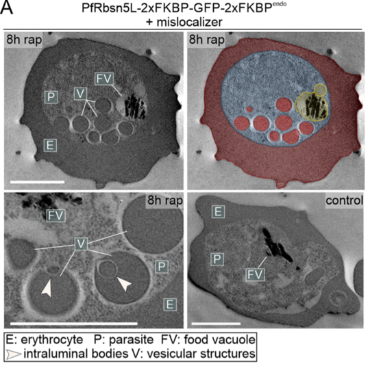 Elektronenmikroskopische Aufnahmen der Vesikel, die nach Entfernung von Rabenosyn-5 entstehen (8h rap) (oben rechts mit falscher Färbung). Unten rechts Kontrollbild, in dem Rabenosyn-5 funktioniert.