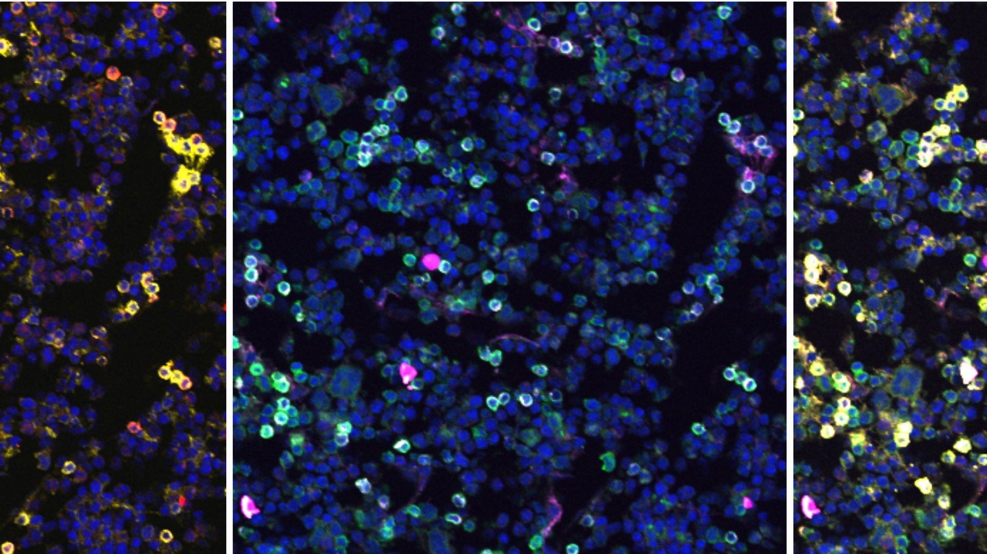Fluorescent imaging of developing B cells in murine bone marrow.