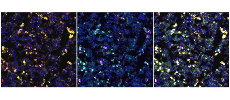 Fluorescent imaging of developing B cells in murine bone marrow.