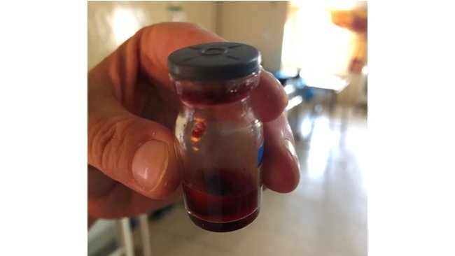 The picture shows a glass vial with blood. A hospital room can be seen in the background.
