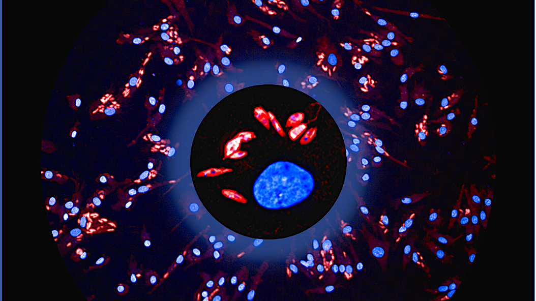 Eine mikroskopische Aufnahme von Leishmanien infizierten Makrophagen. Auf einem schwarzen Huintergrund sind rot und blau gefärbte Zellen zu sehen.