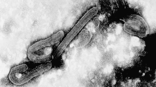 Elektron micrograph picture of the Marburg Virus An electron micrograph of the Marburg virus. In black and white, two rod-shaped viruses can be seen, bent at one end.