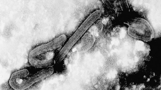 An electron micrograph of the Marburg virus. In black and white, two rod-shaped viruses can be seen, which are bent at one end.