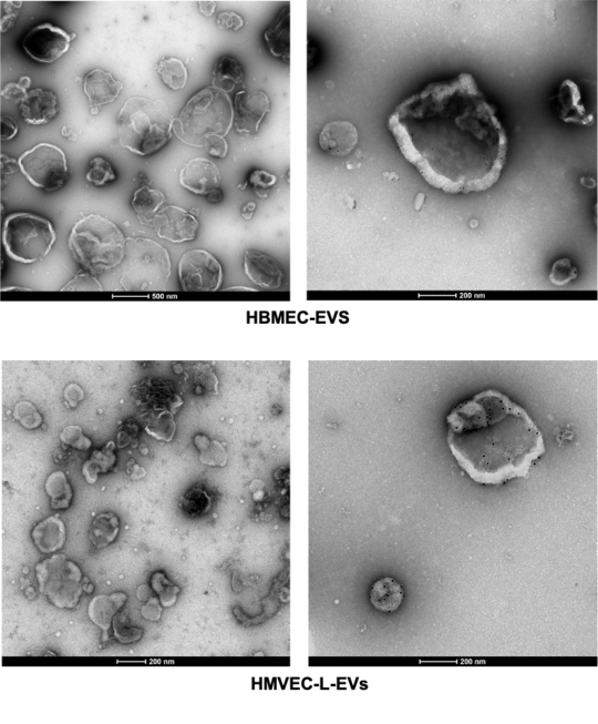 Extracellular vesicles purified from human brain endothelial cells (HBMEC-EVS) and human lung endothelial cells (HMVEC-L-EVs)