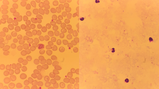 Plasmodium spp. microscope