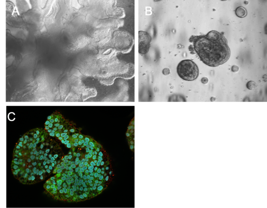 Figure A shows a microscopic transmitted light image of a lung organoid in different shades of grey. It looks three-dimensional, appearing somewhat more compact in the centre and branching out like algae towards the edge. Figure B shows roundish liver organoids also in different shades of grey. They have different sizes, a darker border and roundish bulges. Figure C shows a fluorescence image of a liver organoid. There are many blue coloured roundish structures surrounded by green colour in this organoid, with scattered red dots on the outside. The background is black.