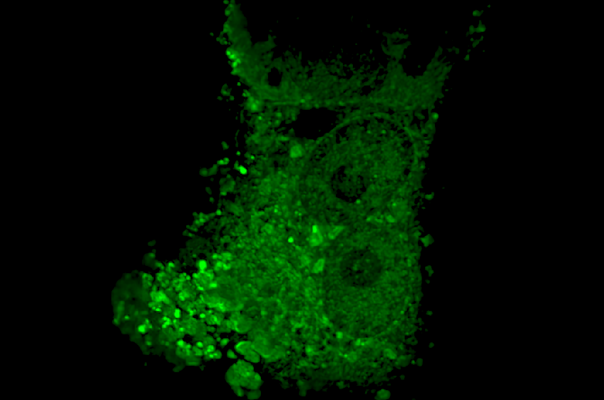 Fluoreszenzmikroskopisches Bild von grünlich leuchtenden Nipah-Viren