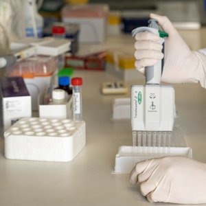 Das Foto zeigt eine Forscherin im Labor beim Pipettieren.