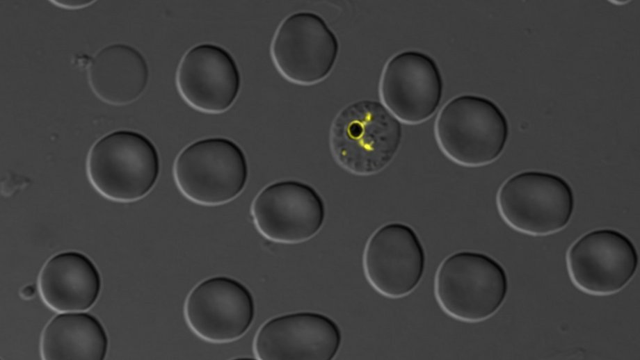 Fluoreszente Malariaparasiten: Graues Bild mit grauen Zellen und gelb leuchteten Malaria-Parasiten