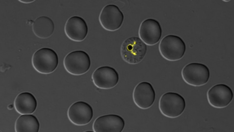 Fluorescent Malaria parasite Fluorescent Malaria parasite: Grey picture with grey cells and yellow glowing parasite.