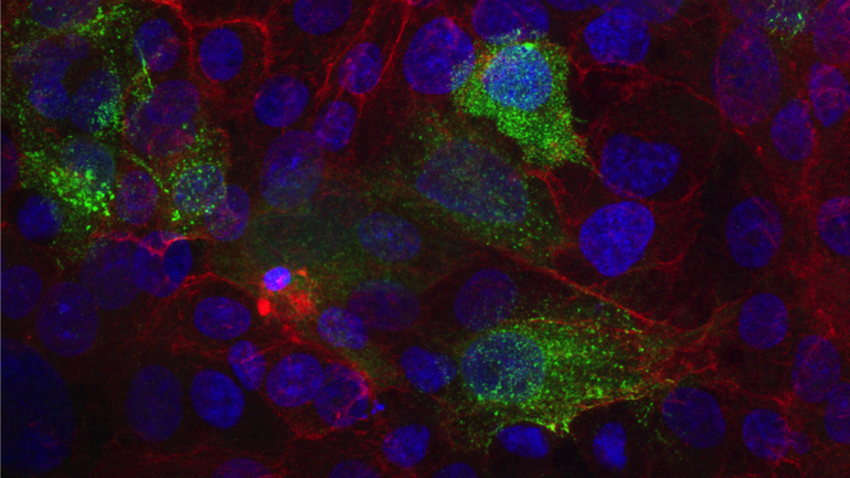 SARS-CoV-2 infected Vero cells with stained, bound SARS-CoV-2 monoclonal antibody 5D4