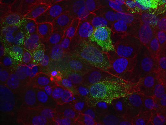 SARS-CoV-2 infizierte Verozellen mit angefärbtem, gebundendenem SARS-CoV-2 monoklonalem Antikörper 5D4