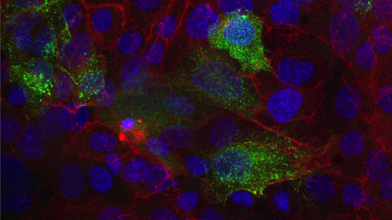 SARS-CoV-2 infizierte Verozellen mit angefärbtem, gebundendenem SARS-CoV-2 monoklonalem Antikörper 5D4
