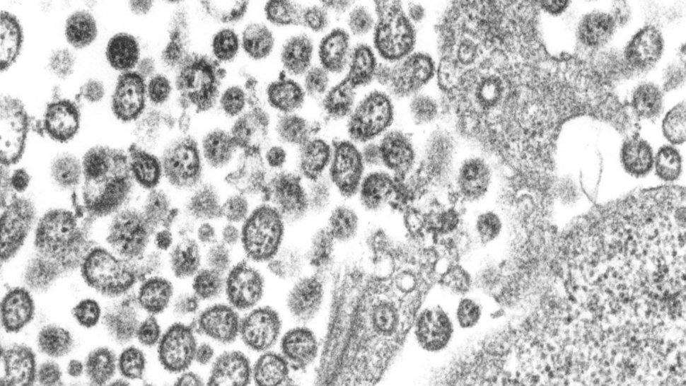 Elektronenmikroskopische Aufnahme von Lassa-Viren