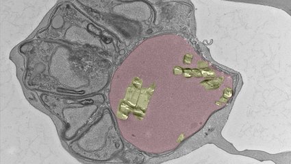 Mikroskopische Aufnahme einer mit Malariaparasiten infizierten Blutzelle.