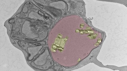 Microscopic image of a malaria parasite and compartments.