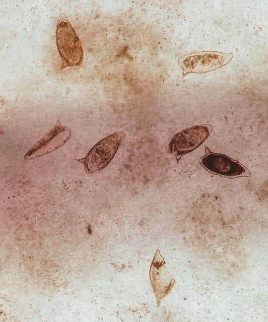 S. mansoni-Ei: Parasitäre Eier, isoliert aus der Leber einer Maus, die 14 Wochen lang mit S. mansoni infiziert war