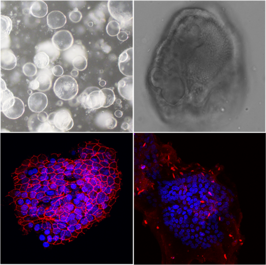 The picture shows four microscopic images of murine liver organoids. Two images show transmitted light images, two other images show fluorescence images with co-cultured Leishmania .