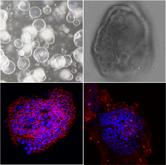 Das Bild zeigt vier mikroskopische Aufnahmen von Leberorganoiden der Maus. Zwei Aufnahmen sind Durchlichtbilder, die beiden anderen sind Fluoreszenzaufnahmen mit gemeinsam kultivierten Leishmania-Parasiten.