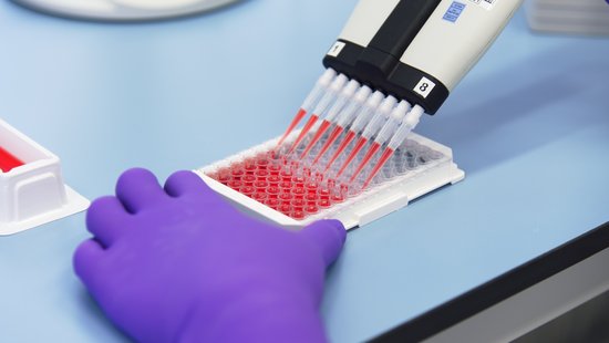 Wir sehen eine Hand in Laborhandschuhen, die eine Probenplatte festhält. Diese wird mit einer Multipipette mit einer roten Flüssigkeit befüllt.