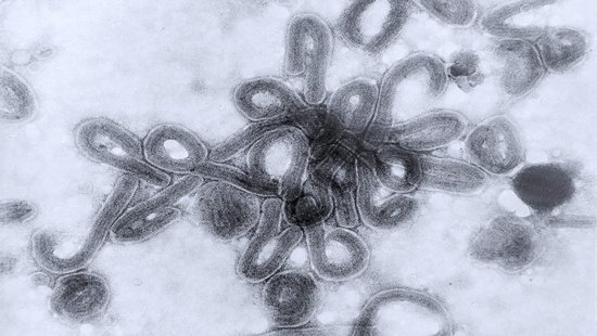 Mikroskopische Aufnahme des Marburg-Virus: eine schwarz-weiß Aufnahme des Marburg-Virus. In der Mitte eine Anhäufung von kurzen, wurmartigen Viren, die sich an einem Ende oft krümmen.