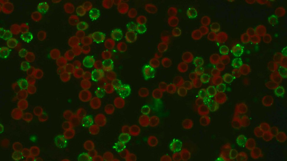 Krim-Kongo-Hämorrhagisches-Fieber-Virus (indirekte Immunfloureszenz)