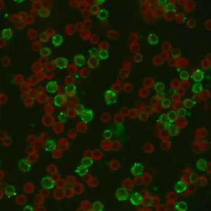 Krim-Kongo-Hämorrhagisches-Fieber-Virus (indirekte Immunfloureszenz)