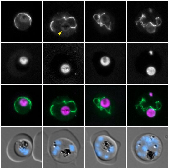 Es sind fluoreszierende Parasiten zu sehen.