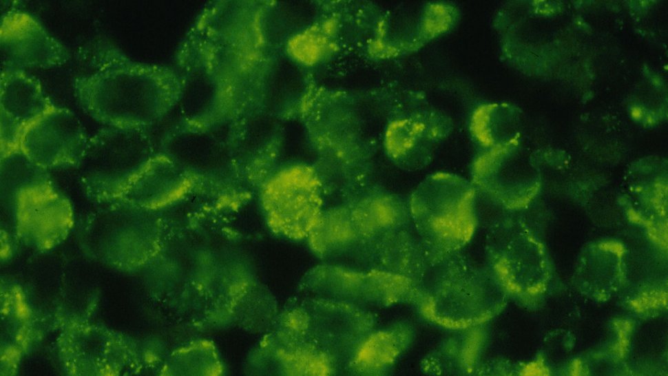 Elektronenmikroskopisches Bild von Dengue-Viren Das elektronenmikroskopische Foto zeigt eine Vielzahl rundlicher hellgrüner Dengue-Viren vor schwarzem Hintergrund.