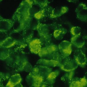 Das elektronenmikroskopische Foto zeigt eine Vielzahl rundlicher hellgrüner Dengue-Viren vor schwarzem Hintergrund.