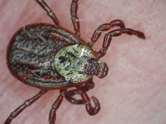 Dermacentor Reticulatus leicht von frontal schräg oben auf der Haut eines Menschen.